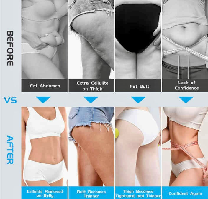Portable Anti-Cellulite Massager